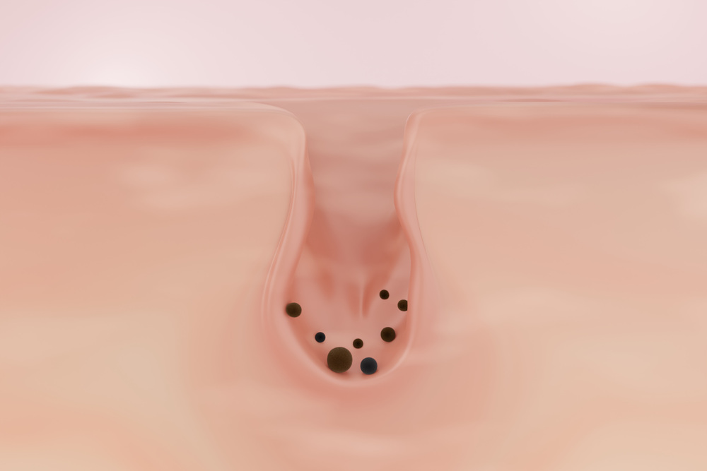 毛穴が詰まっている様子