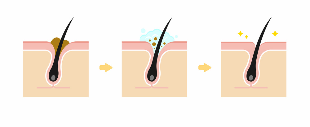 毛穴洗浄の工程