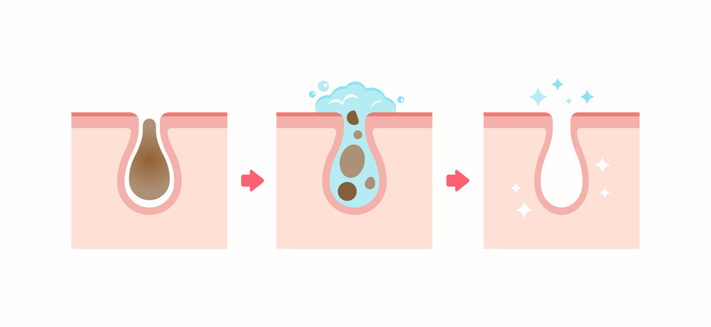 毛穴洗浄の工程