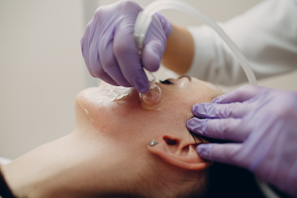 毛穴洗浄の施術中