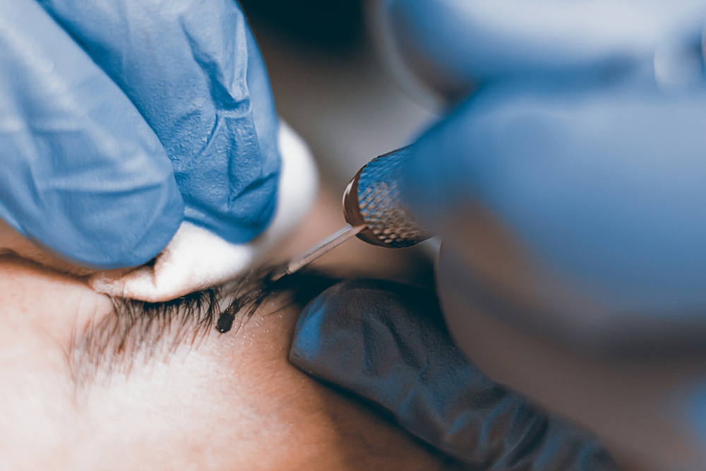 眉毛アートメイク施術中