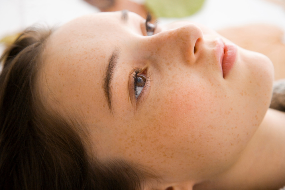 肌にできたそばかす